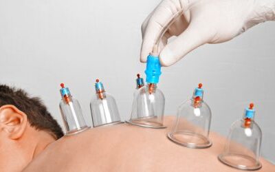 افضل حجامه بالرياض أبوياسين 0535525019