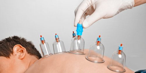 افضل حجامه بالرياض أبوياسين 0535525019