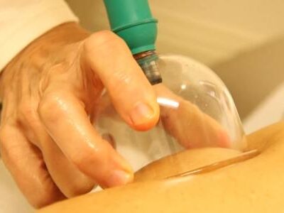 افضل حجامه بالرياض أبوياسين 0535525019