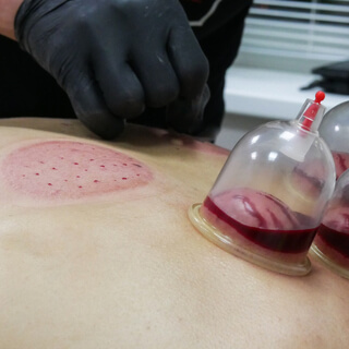 افضل حجامه بالرياض أبوياسين 0535525019